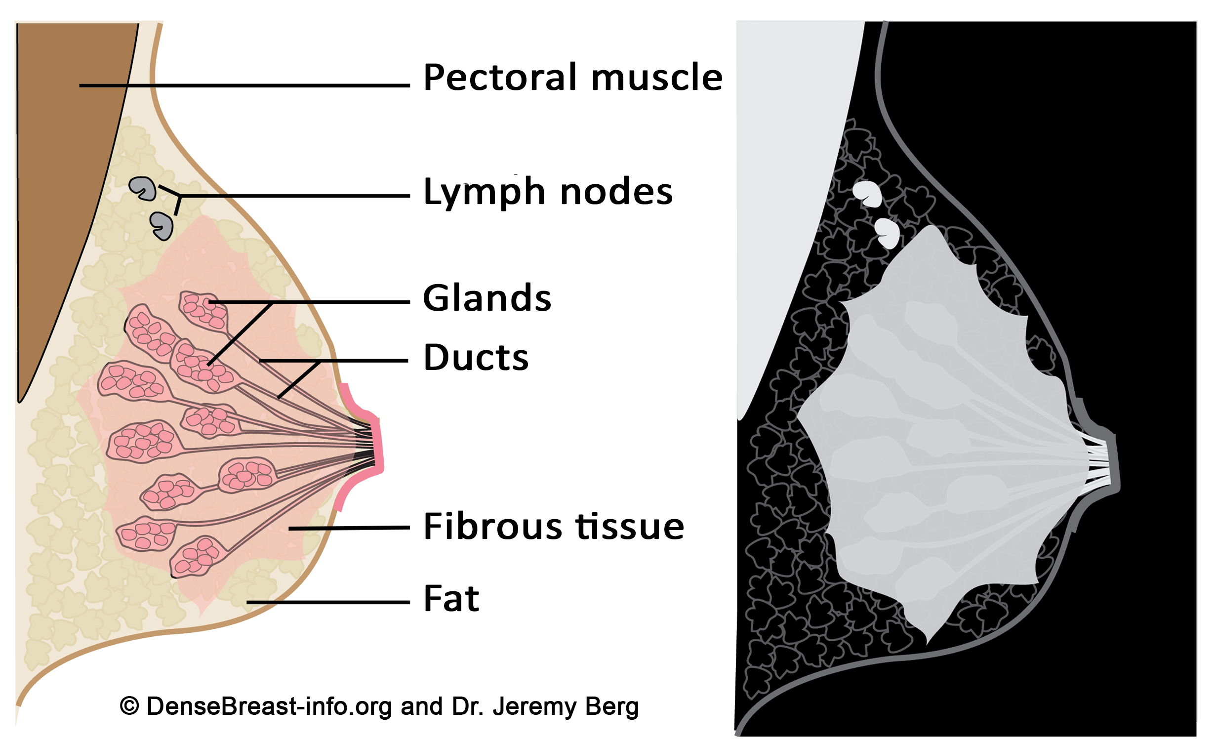 Breast Density